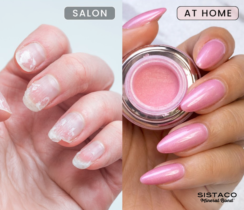 Ensemble d'ongles à liaison minérale